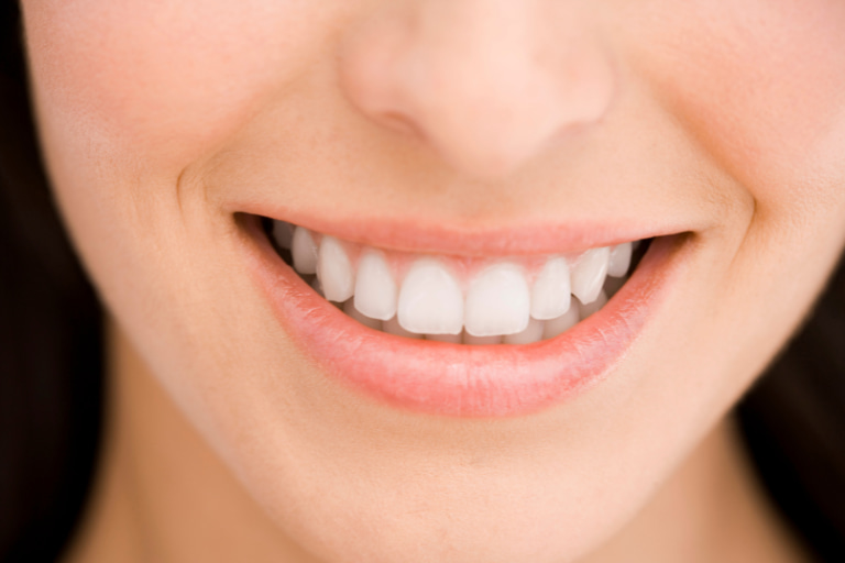 blanqueamiento dental en malaga