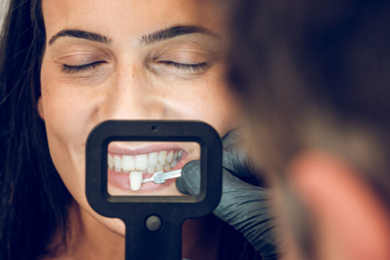 especialistas estetica dental barcelona