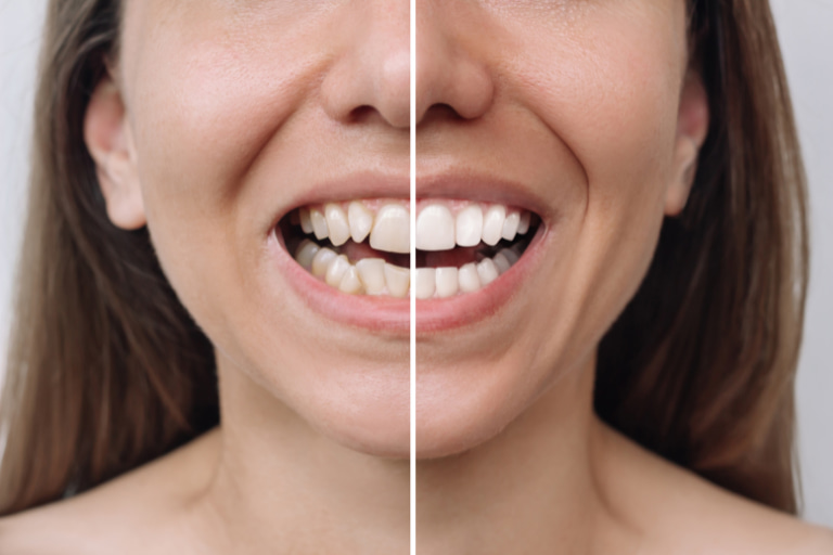 especialistas estetica dental malaga