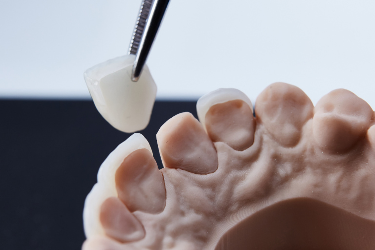 tratamientos estetica dental barcelona