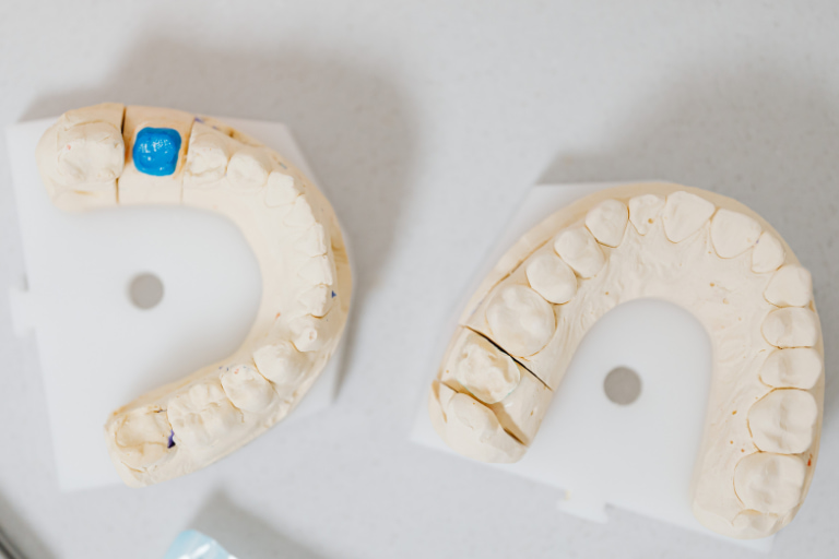 tratamientos estetica dental malaga