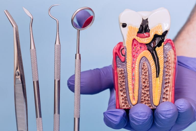 clinica endodoncia málaga