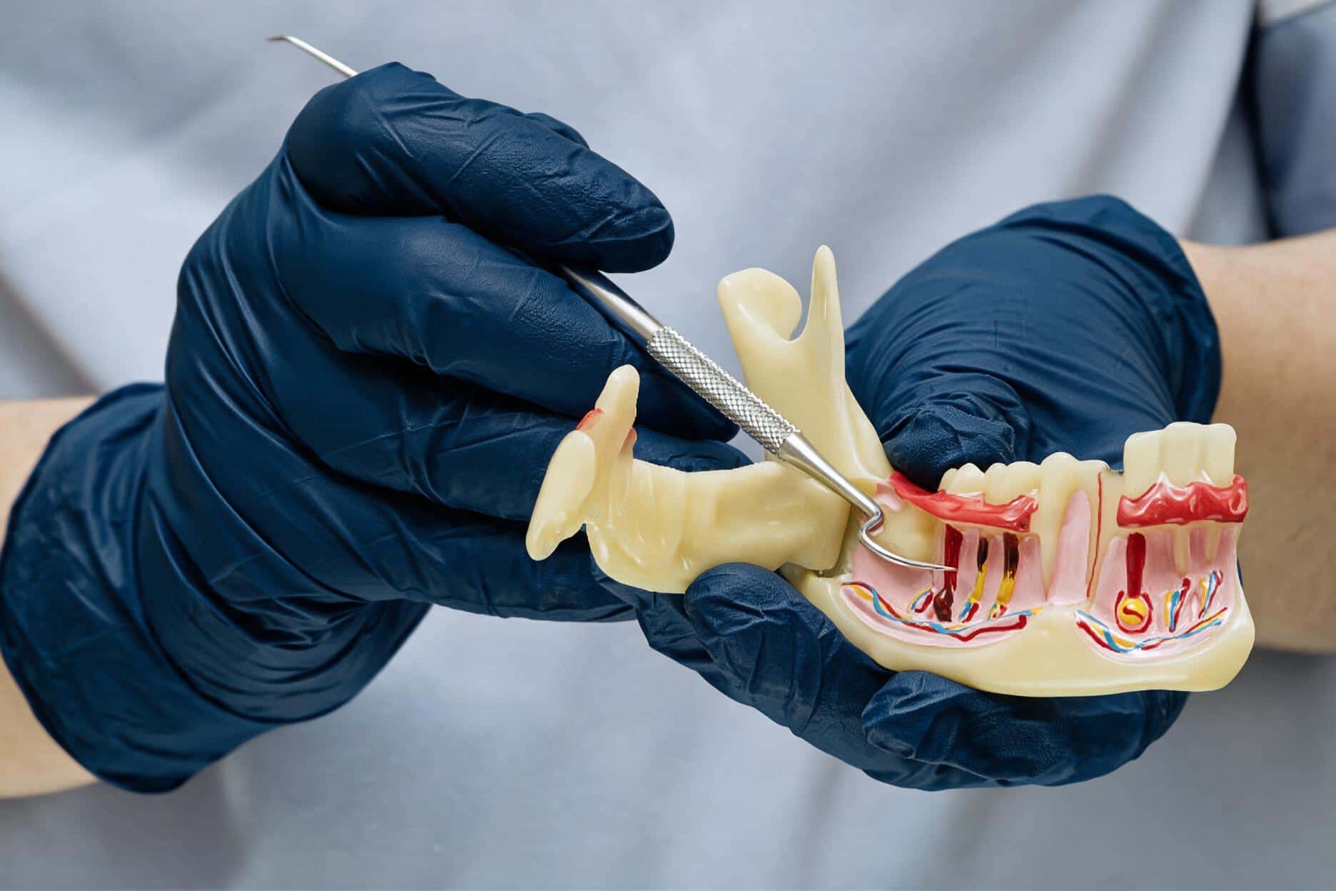 clinica periodoncia barcelona